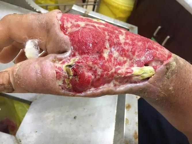 澳門開獎結(jié)果+開獎記錄表013和被蛇咬反抓蛇再遭咬與被蛇咬反抓蛇再遭咬傷